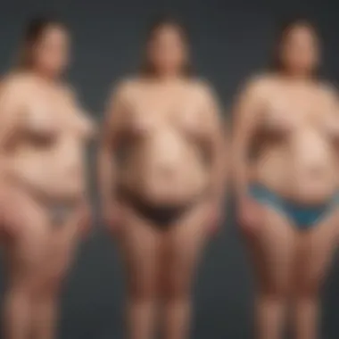 Visual representation of non-morbid obesity illustrating its different stages and implications.