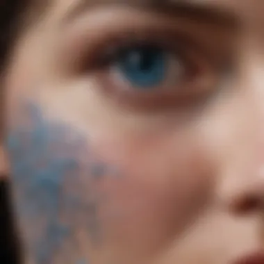 Clinical Features of Blue Nevus Clinical presentation of blue nevus