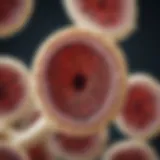 Microscopic view of bone marrow cells affected by AML