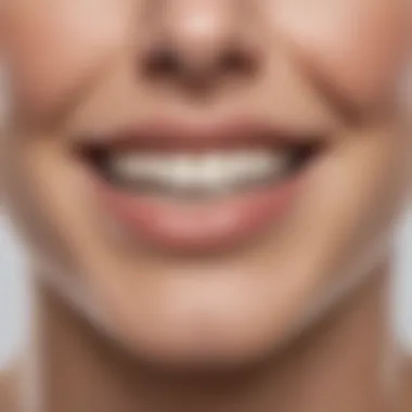 Comparison of Teeth Whitening Methods Comparison chart of teeth whitening methods