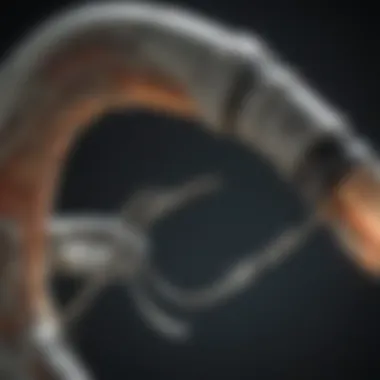 Advanced Visualization Techniques in G Arm Fluoroscopy Visualization technique using G Arm fluoroscopy