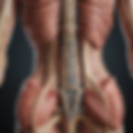 Detailed anatomical diagram of the spinal cord showcasing herniation
