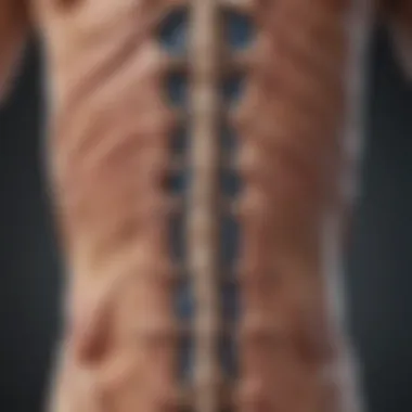 Illustration depicting the physiological effects of spinal cord herniation