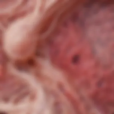 Histological slide demonstrating the features of fatty hilum in lymphatic tissue