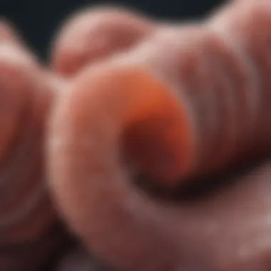 Diagnostic Criteria for Inter Colitis Chart showing diagnostic criteria for inter colitis