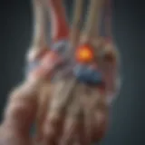 Anatomical diagram of the foot highlighting plantar spurs