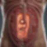 Metastatic spread of colon cancer