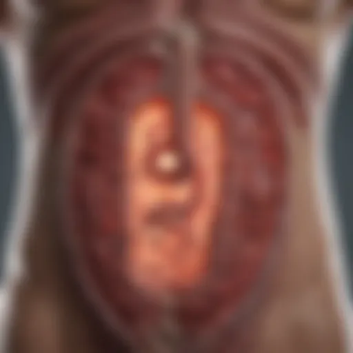 Metastatic spread of colon cancer