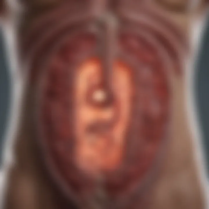 Metastatic spread of colon cancer