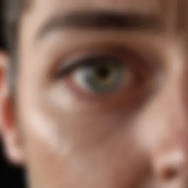 Common Disorders Affecting the Optic Nerve Illustration of optic nerve disorders