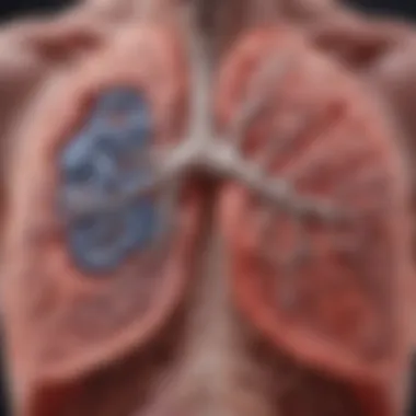 Schematic representation of the pathological changes in the lungs due to pneumonia