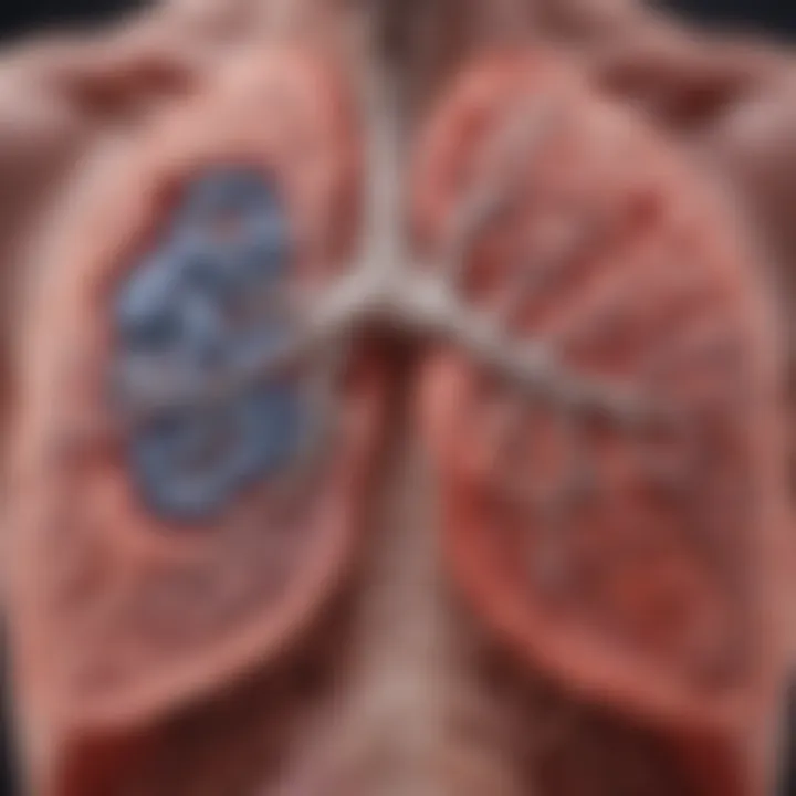 Schematic representation of the pathological changes in the lungs due to pneumonia