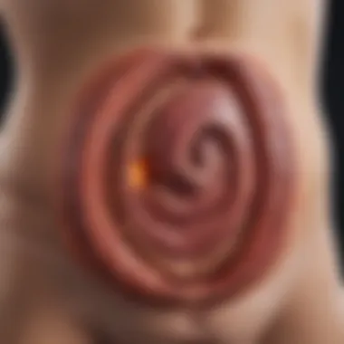 Understanding Ulcer Formation Diagram illustrating the layers of the stomach and ulcer formation.