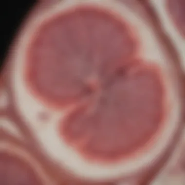 Histological Examination of Glioma Histological slide showcasing glioma cells