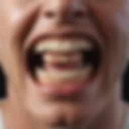 Types of dentures available under the NHS