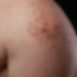 Dermatological examination showcasing lentiginous melanoma