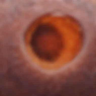 Histopathological slide illustrating the characteristics of lentiginous melanoma