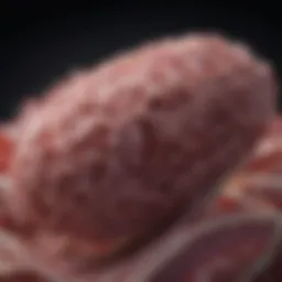 Illustration of pancreatic carcinoid tumor pathology