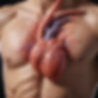 Inflammation in Viral Cardiomyopathy Diagram illustrating the inflammation in the heart muscle due to viral infections