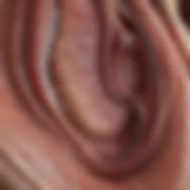 Diagram illustrating peptic ulcers