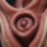 Anatomical illustration of the vulva highlighting tumor locations