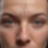 Diagram illustrating the coronal suture and its significance in craniosynostosis